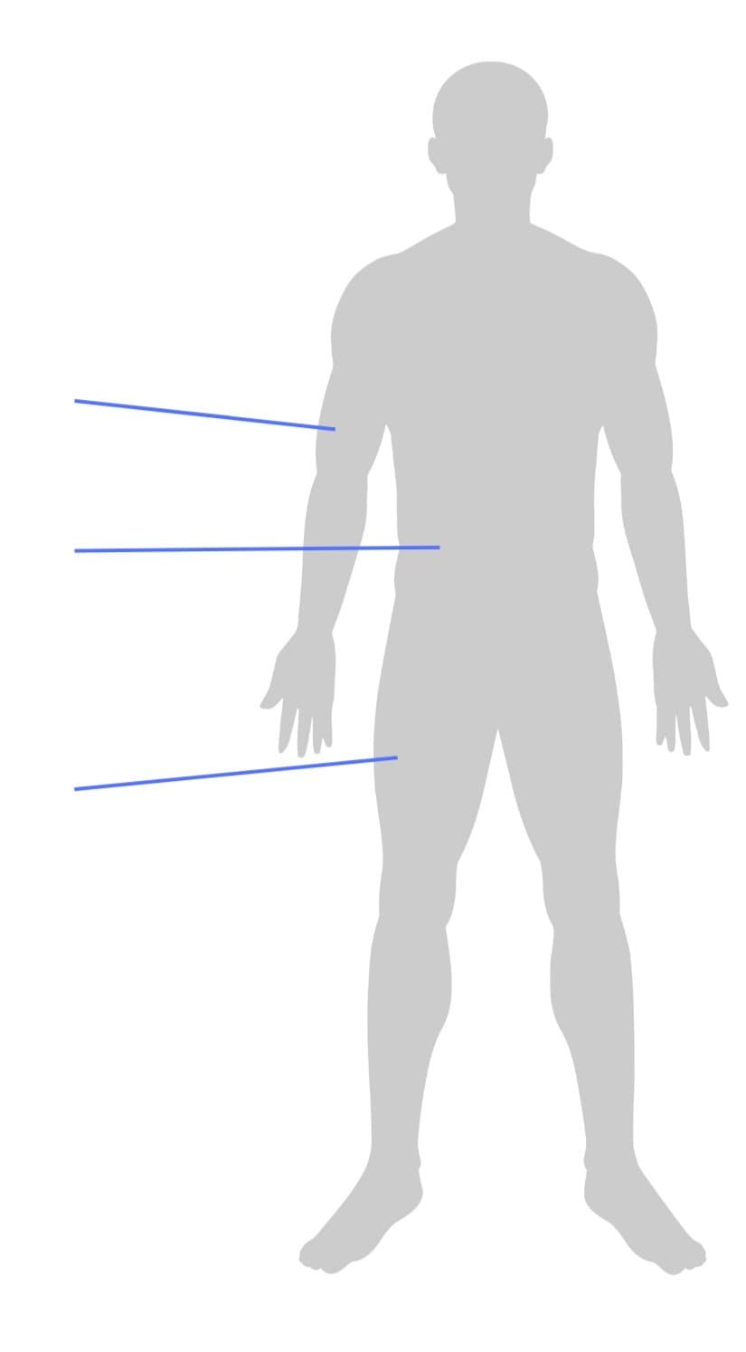 Outline of a human body with lines pointing to arm, thigh and abdomen.